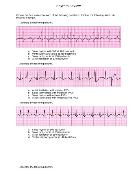 ekg rhythm review questions - Rhythm Review Choose the best answer for ...