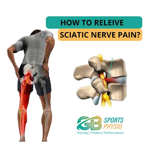 How to Releive Sciatic Nerve Pain