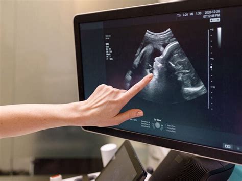 Registry Review Ultrasound: What Does It Really Mean? - Marninixon.com