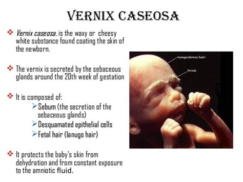 Newborn in Vernix Caseosa | Anatomy and physiology, Anatomy study, Physiology