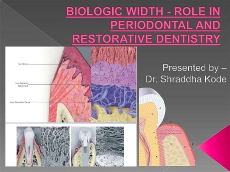 Biologic width - Importance in Periodontal and Restorative Dentistry