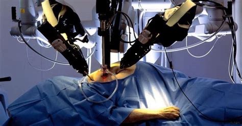 Should surgical robots replace human surgeons?: Here is what the ...