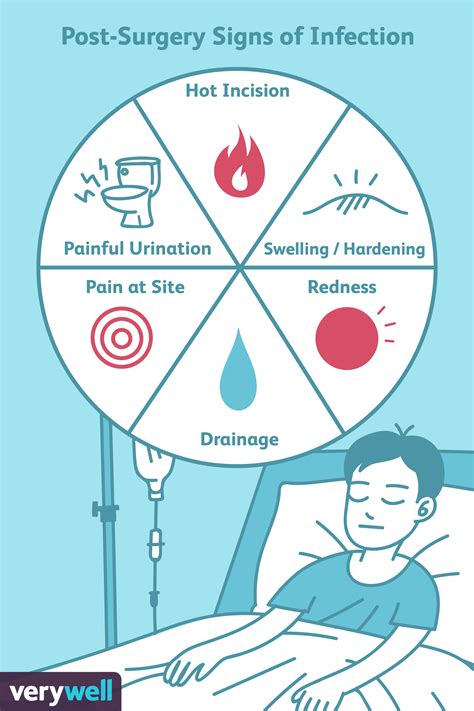 Signs of an Infection After Surgery | After surgery, Surgery nursing, Surgery