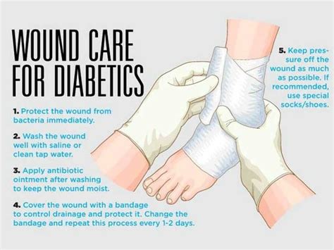 Home Care for Diabetic Wounds | Madurai Footcare Centre