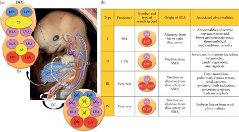 Umbilical Artery Ultrasound