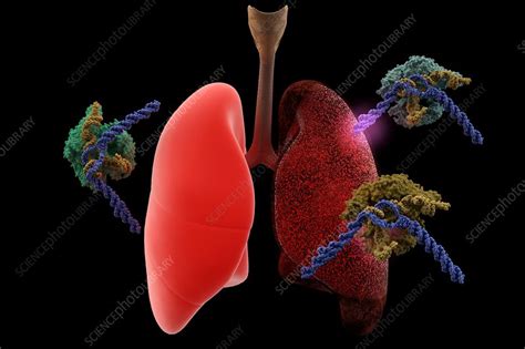 CRISPR gene editing cancer treatment - Stock Image - C030/3417 - Science Photo Library