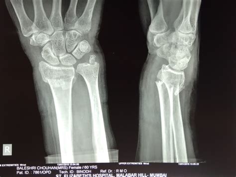 Case 2 - Bone & Joint Clinic