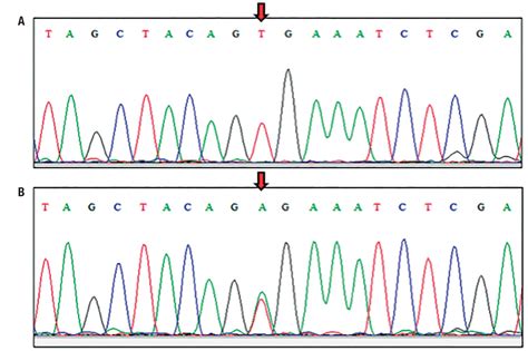 Association between BRAF (V600E) mutation and clinicopathological features of papillary thyroid ...