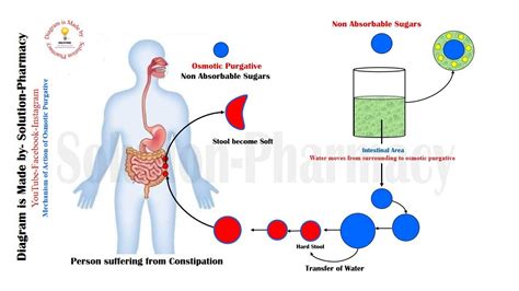 Constipation= Mechanism of Action of Osmotic Purgative | Osmotic ...