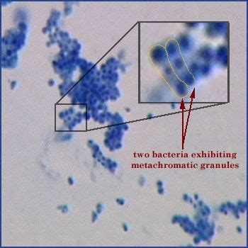 Corynebacterium with Metachromatic Granules and Methylene Blue