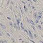 Types of Mesothelioma | Location, Cell Types & Malignancy