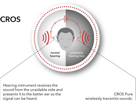 CROS and BiCROS Hearing Aids, Why, When and The Results