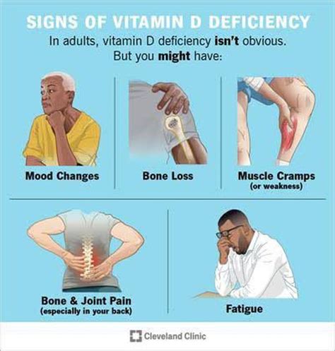 Vitamin d deficiency - MEDizzy