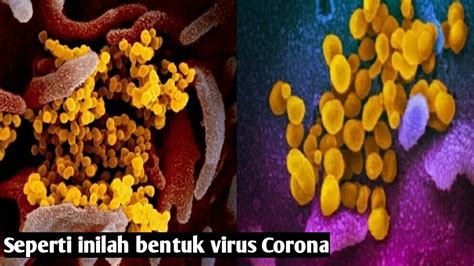 Seperti inilah bentuk virus corona - YouTube