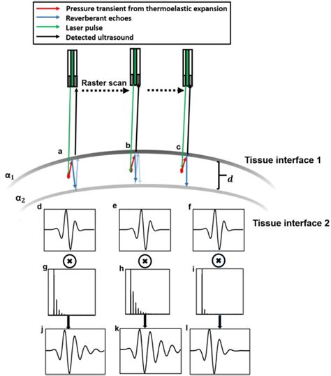 Dictionary learning-based reverberation removal enables depth-resolved photoacoustic microscopy ...