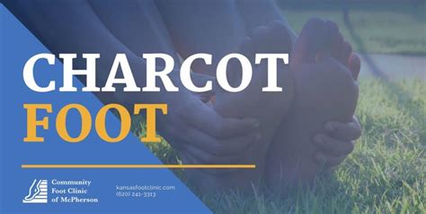 Charcot Foot Treatment Options | Community Foot Clinic of McPherson