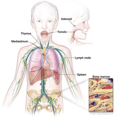 Hodgkin Lymphoma (Hodgkin Disease) in Children | CureSearch