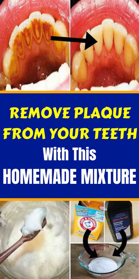 Remove Plaque From Your Teeth With This Homemade Mixture | Holistic And Healthy