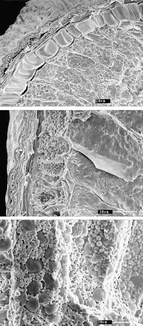 Endosperm structure of spring wheat kernels in healthy kernels of... | Download Scientific Diagram