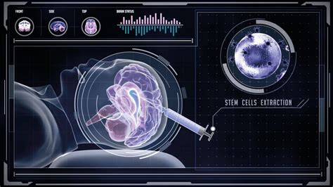 Extracting Autologous Neural Stem Cells for Treatment of ...