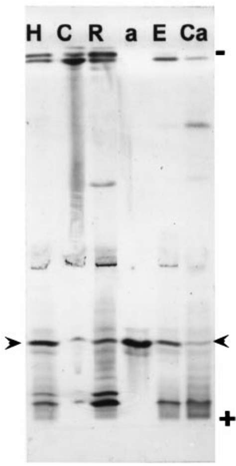 Peroxidase isoenzymes from various fractions of zucchini seedlings... | Download Scientific Diagram