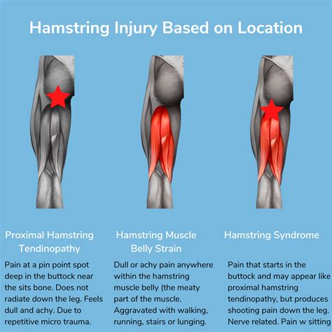 How To Support A Hamstring Injury at Elizabeth Lowell blog