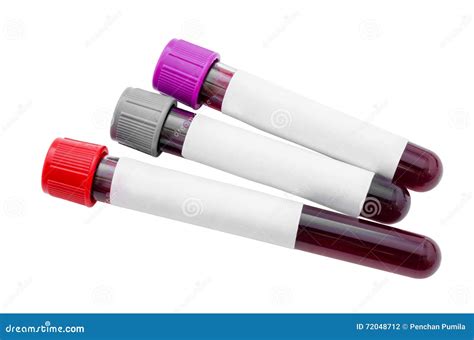 Blood Sample In Test Tubes Stock Photography | CartoonDealer.com #36604448