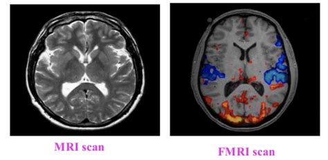 Show Your Work! - Methods to Study the Brain