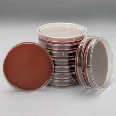 Columbia Agar with 5% Sheep Blood, Prepared Media Plates, 100 x 15 mm ...