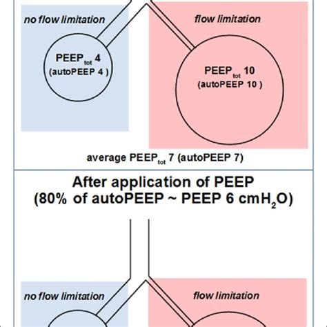 Effect of PEEP on areas with and without flow limitation. In the upper ...