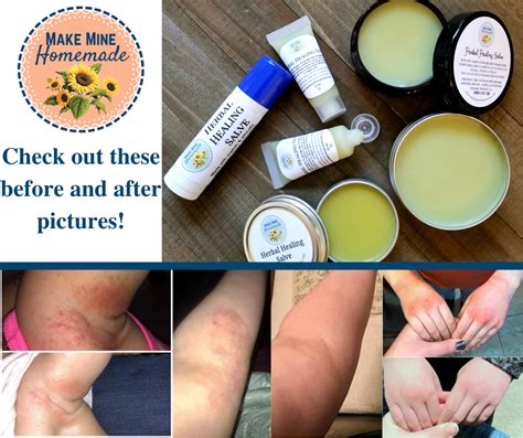 Herbal Healing Salve – MakeMineHomemade