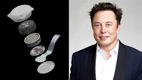 Technology News | Elon Musk’s Neuralink Brain Implant Gets US FDA Approval for First Human ...