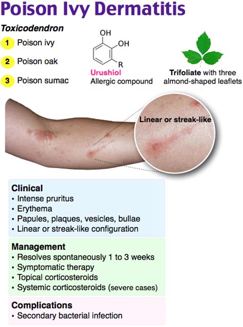 Poison Ivy Dermatitis | Medical education, Nursing tips, Nursing fun