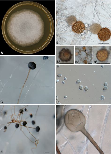 Macroscopic and microscopic morphology of Rhizopus microsporus CBS... | Download Scientific Diagram