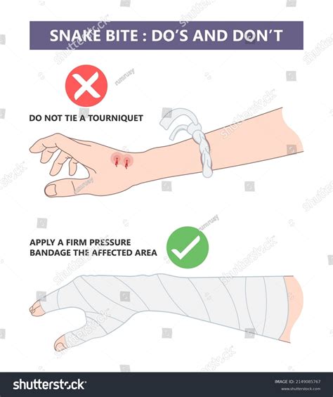 Poisonous Snake Bite Wounds