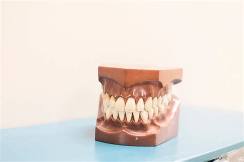 What Causes Teeth to Crack? How It Can Be Treated?