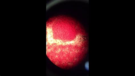 Sangre vista desde el microscopio - YouTube