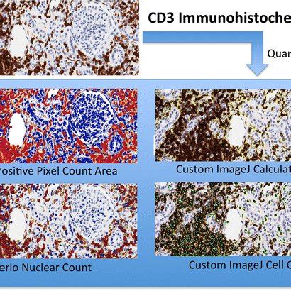 CD3 detection methods detected CD3-staining cells on a qualitative ...