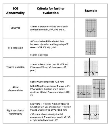 New Guidelines to Improve ECG/EKG Interpretation in Athletes - Guest ...