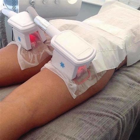 Cryolipolysis - Fat Freezing Treatments | Beauty & Aesthetics Salon ...