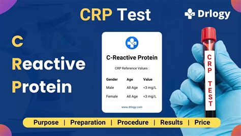 C-Reactive Protein (CRP) Test Introduction, Principle,, 46% OFF