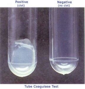 Coagulase Test- Principle, Procedure, Types, Interpretation and Examples