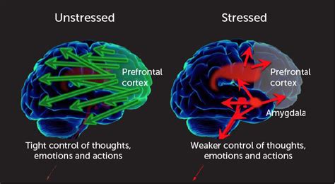 How stress affects your brain