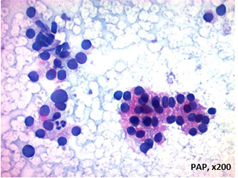 Frontiers | Editorial: Subclassification of AUS/FLUS category for ...