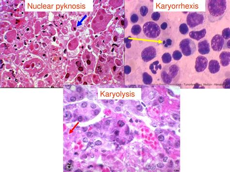 PPT - Cell injury-3 PowerPoint Presentation, free download - ID:1930325