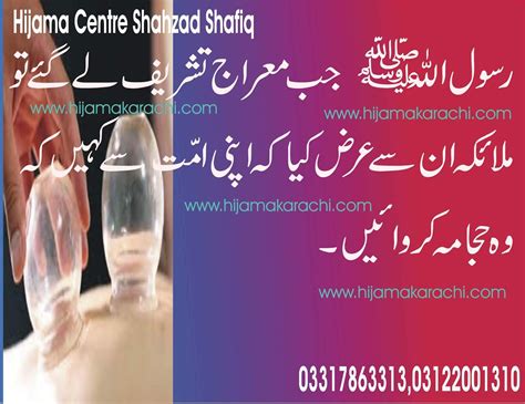 Hijama : Hijama points . # Hijama benefits # Hijama Karachi #Hijama treatment # Hijama Pakistan ...