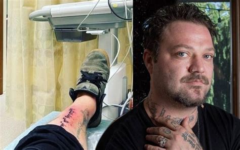 Bam Margera Hospitalized After Tattoo Nightmare Develops Staph Infection