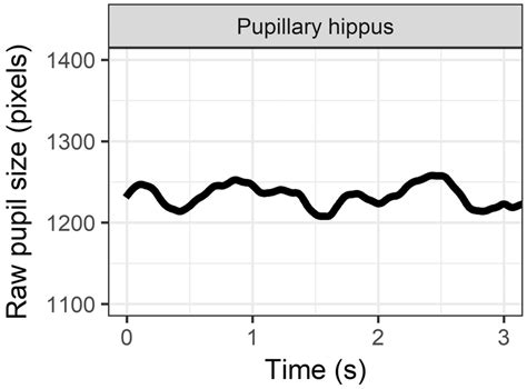 Pupillary hippus, or small ongoing fluctuations in pupil size that are... | Download Scientific ...