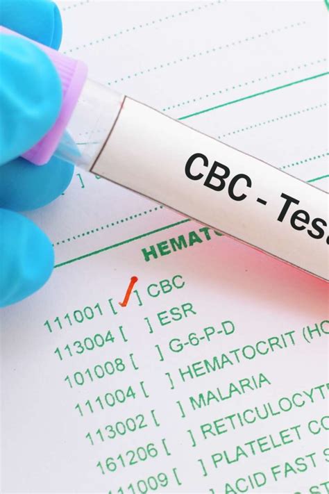 High MCHC: Causes, treatment, and symptoms