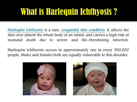 PPT - Harlequin Ichthyosis: Causes, symptoms, complications and ...